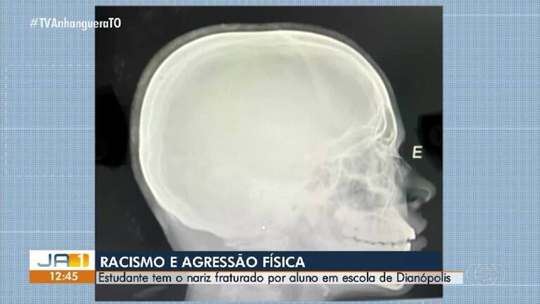 VÍDEOS: Jornal Anhanguera 1ª Edição-TO de quarta-feira, 11 de março de 2026 videos:-jornal-anhanguera-1a-edicao-to-de-quarta-feira,-11-de-marco-de-2026