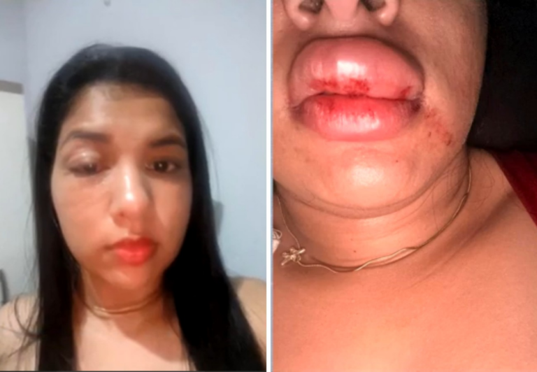 ‘estou-tendo-que-me-esconder’,-desabafa-jovem-que-denunciou-vereador-por-agressao-no-tocantins