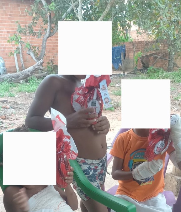 Família desesperada pede ajuda para crianças que foram queimadas familia-desesperada-pede-ajuda-para-criancas-que-foram-queimadas